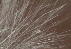 Sony NEX-5R: fázový posun k lepšímu?