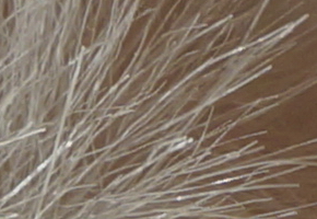 Sony NEX-5R: fázový posun k lepšímu?