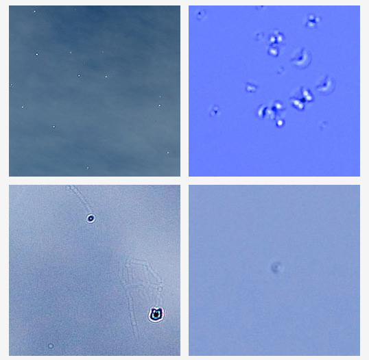 Leica má problémy s rozežíráním snímače v dálkoměru M9