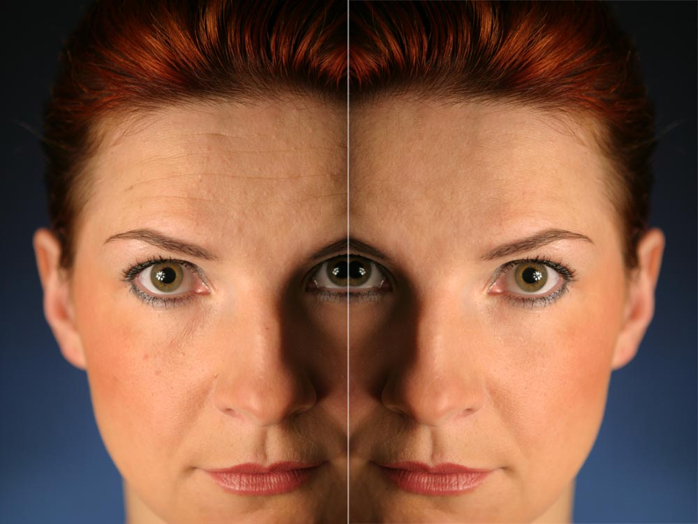 Úpravy fotografií v PC, 9.díl - retuš