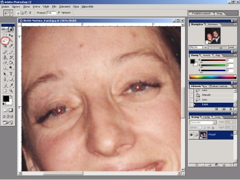 Odstranění červených očí