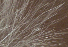 Sony NEX-5R: fázový posun k lepšímu?