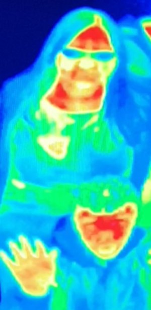 Žena díky termální kameře v muzeu odhalila rakovinu prsu