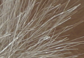 Sony NEX-5R: fázový posun k lepšímu?