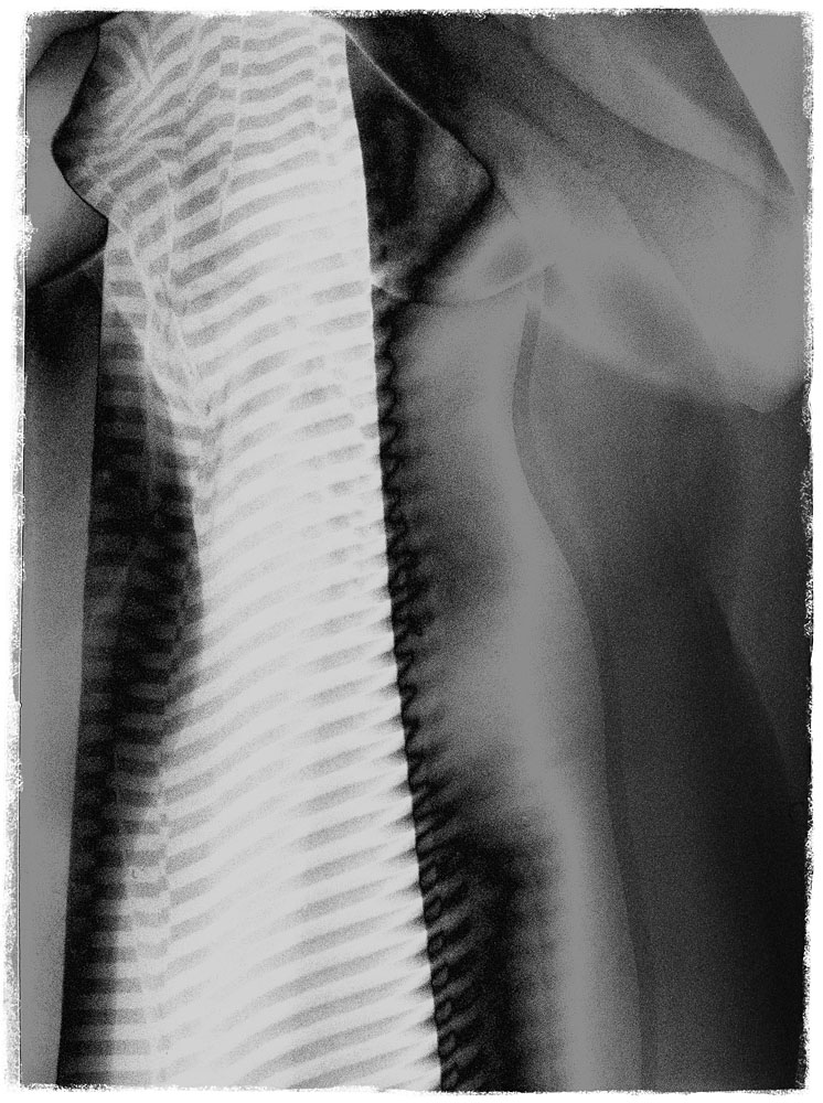 Akta o aktu 04: Umění, kýč nebo porno?