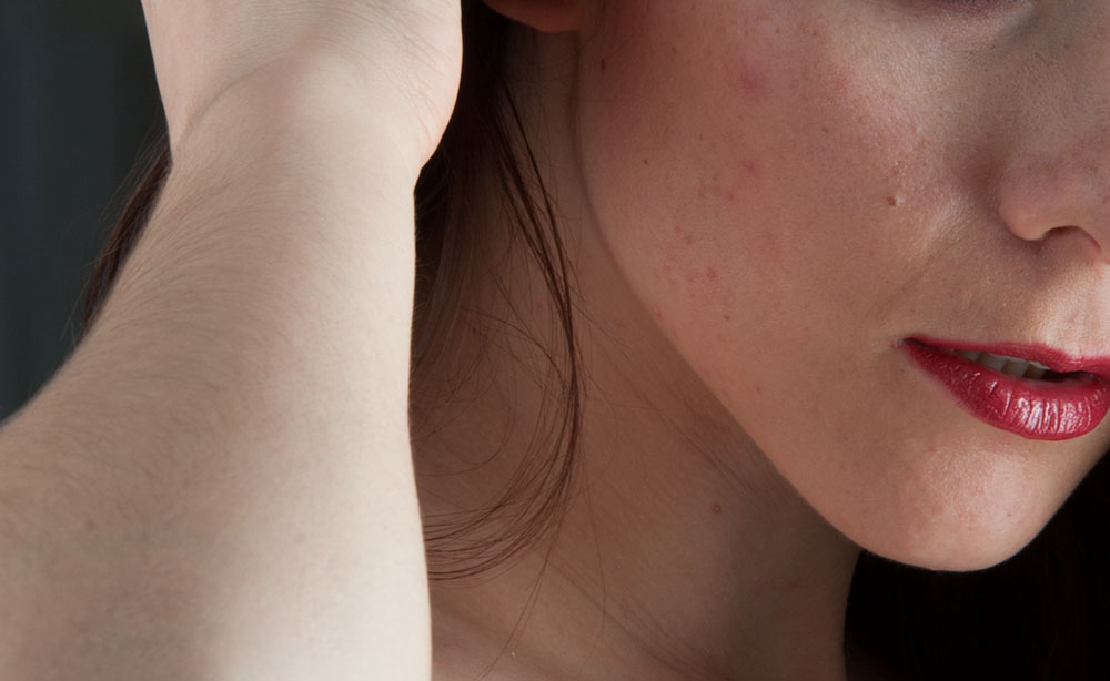 Akta o aktu 15: Tělesné vady – líčení, maskování, retuš